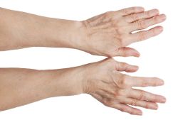 Причины появления шишек на пальцах рук, методы лечения