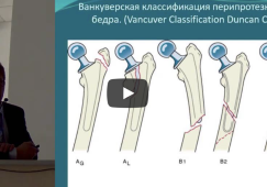 Адамово яблоко лечение суставов рецепт видео