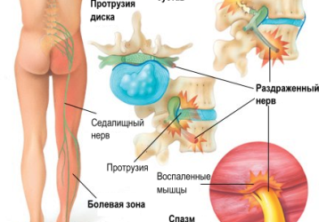 Спина Доктор