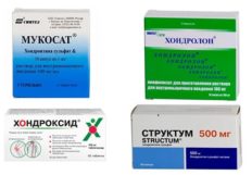 Лечение артроза коленного сустава 3 степени без операции