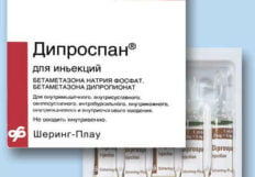 Артроз коленного сустава 2 степени как лечить