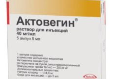 Виды растяжения