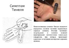 Разбираемся что делать и как лечить боль в тазобедренном суставе