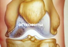После приседаний болят ноги
