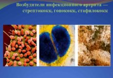Здоровая осанка