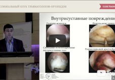 Видео презентация: профилактика гонартроза у пациентов с внутрисуставными переломами. А.П. Афанасьев (Москва)