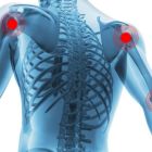 Хруст в суставах – причины возникновения и методы его лечения