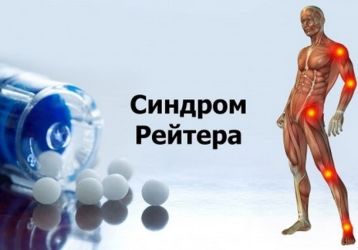 Болезнь Рейтера: симптомы у женщин и мужчин, лечение