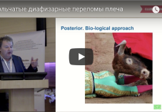 Видео доклад: оскольчатые диафизарные переломы плеча. А.А. Волна (Москва