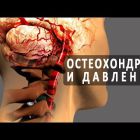 Шейный остеохондроз и артериальное давление: причины взаимосвязи Гипертонии