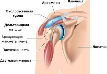 Синовит плечевого сустава: симптомы и лечение