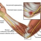 Тендинит локтевого сустава: причины, симптомы, основные методы лечения