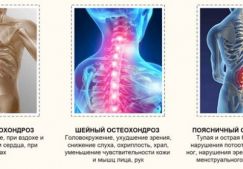 Можно ли париться в бане при остеохондрозе шейного, грудного и поясничного отдела