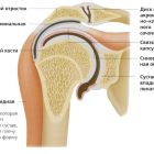 Лечение деформирующего артроза плечевого сустава