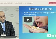 Видео: боль после эндопротезирования: инфекция или нестабильность? Подкосов О.Д. (Москва)