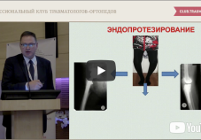 Видео: хондропротекторы при посттравматическим остеоартрите. Доклад А.Н. Решетникова (Саратов)