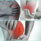Бурсит — причины, симптомы и лечение заболевания