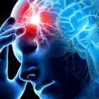 Препараты улучшающие мозговое кровообращение и память при шейном остеохондрозе