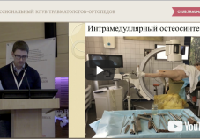Видео: вертельные переломы, хирургическая техника. Доклад Д.А. Новикова (Волгоград)