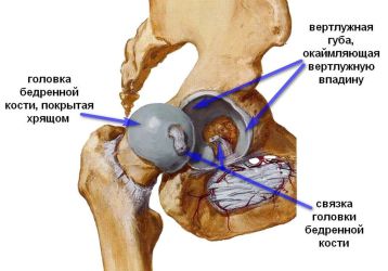 Основные болезни тазобедренного сустава: как установить и лечить