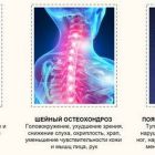 Обезболивающее при остеохондрозе: какие препараты лучше всего снимают боль?