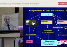 Видео презентация: современные способы диагностики и лечения остеоартрита. Докладчик — В.В. Бадокин (Москва)
