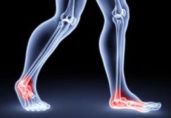 Оценка состояния тазобедренных, голеностопных и коленных суставов