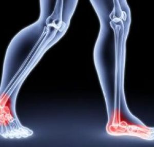 Оценка состояния тазобедренных, голеностопных и коленных суставов
