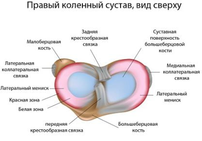 Как лечить мениск коленного сустава в домашних условиях