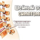 Сосудорасширяющие препараты в терапии шейного остеохондроза
