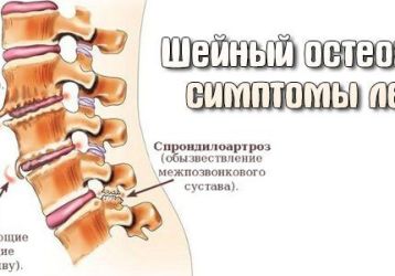 Сосудорасширяющие препараты в терапии шейного остеохондроза