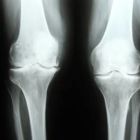 Рентген суставов