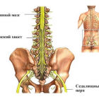 Симптомы и лечение синдрома конского хвоста в пояснице