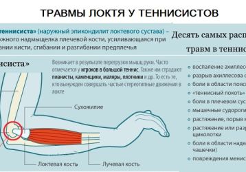 Локоть теннисиста: что нужно знать о заболевании, симптомы и лечение