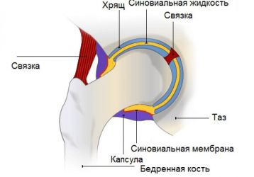 Синовит тазобедренного сустава: лечение, пункция, антибиотики, медикаменты