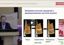 Видео презентация: базовые принципы остеосинтеза. А.А. Волна (Москва)