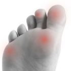 Ревматизм ног — признаки и лечение, полное описание заболевания