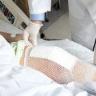 Правила реабилитации после эндопротезирования коленного сустава