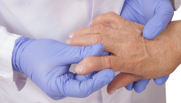 Ревматоидный артрит: симптомы и эффективное лечение