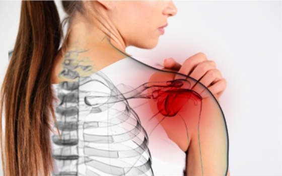 Что такое периартрит плечевого сустава