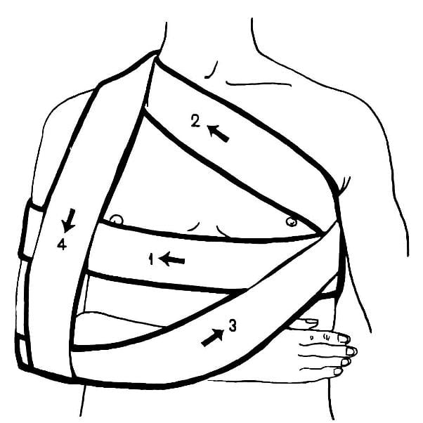 Питание при вывихе плечевого сустава