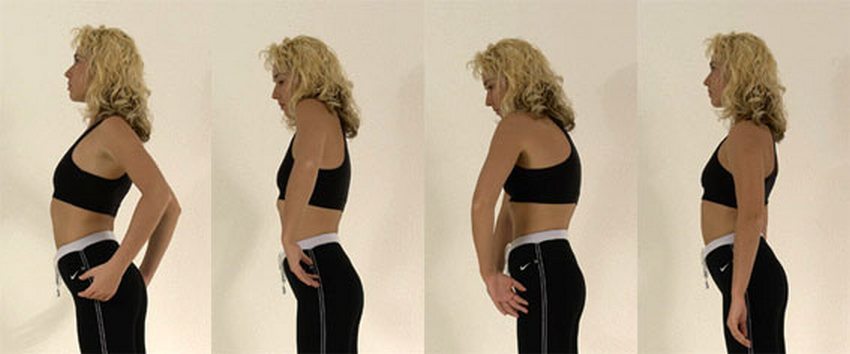 Повреждения мышц при вывихе плечевого сустава