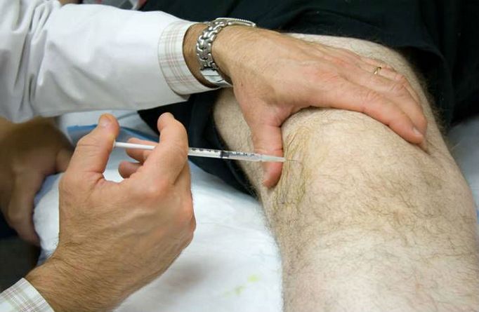 Инъекция гиалурона в колено