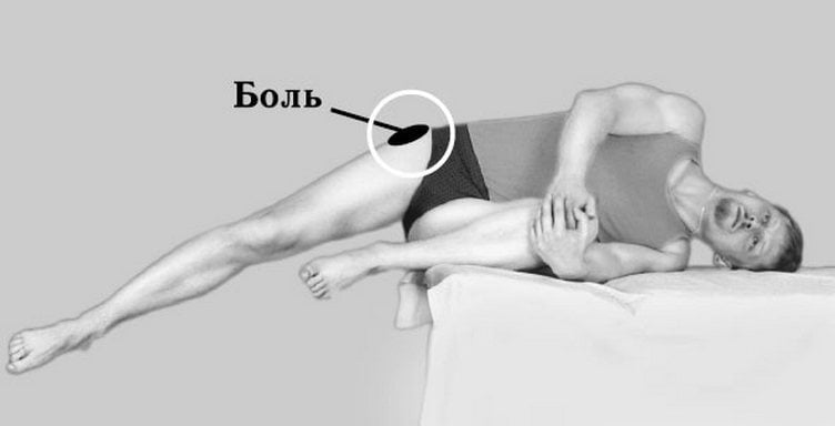 Изображение - Боль в тазобедренном суставе во время сна bolit-tazobedrennyj-sustav-nochyu-chto-delat