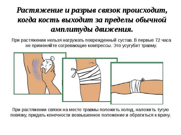 Изображение - Надрыв передней крестообразной связки коленного сустава лечение nadryv-krestoobraznoj-svyazki-kolennogo-sustava