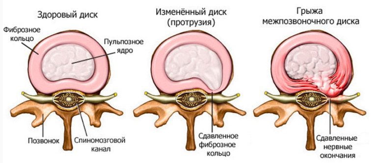 Боль в локтевом суставе правой руки