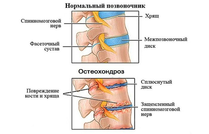 Изображение - Лечение суставов препараты последнего поколения Hondroprotektory-poslednego-pokoleniya