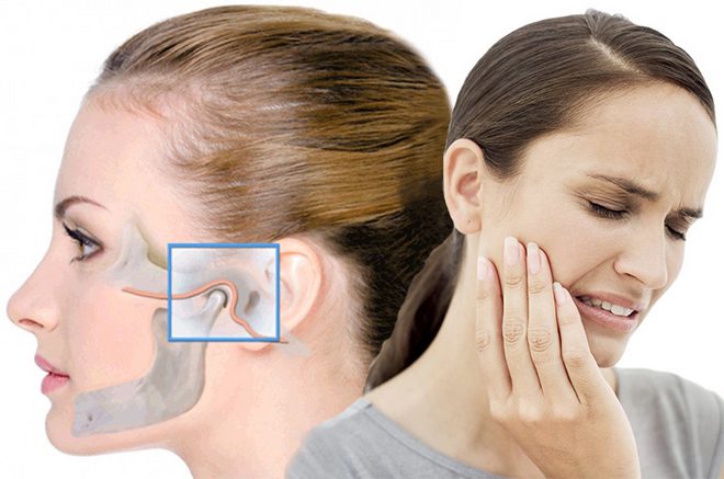 Артрит височно челюстного сустава симптомы и лечение
