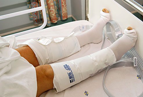 Восстановительное лечение при эндопротезировании коленного сустава