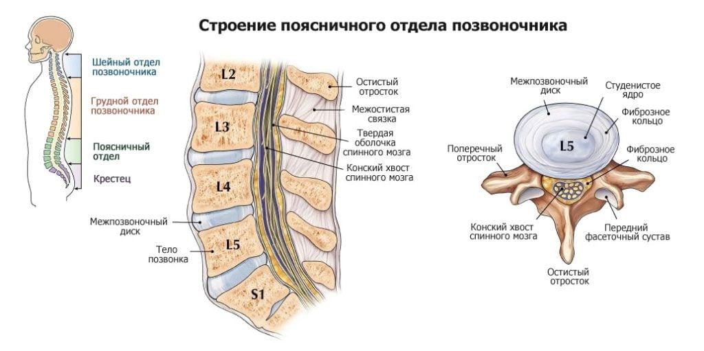 Артроза и сколиоза позвоночника